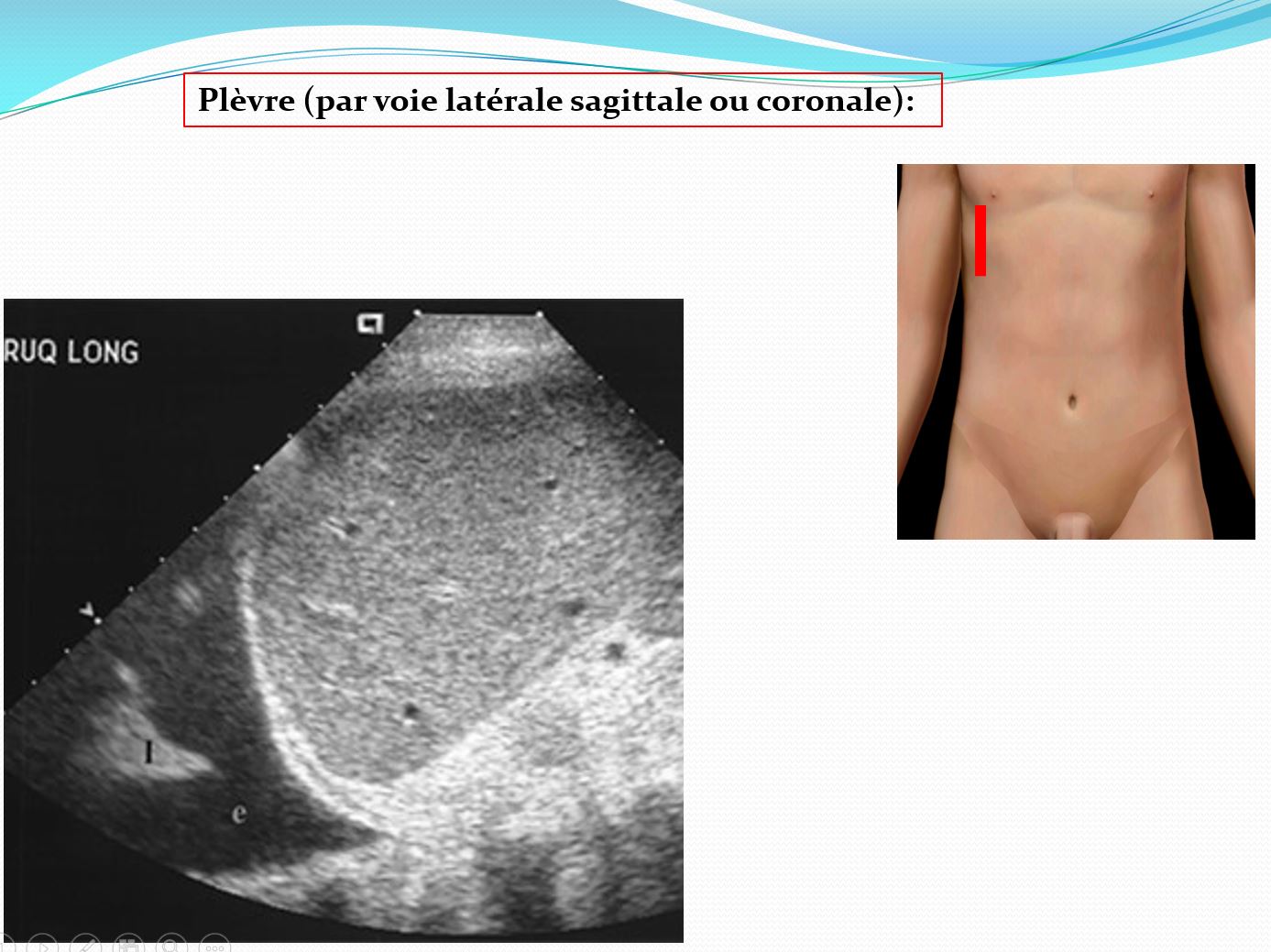 KIKEOS ACADEMY : FMC à Distance en Echographie Générale et Obstétricale