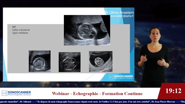 KIKEOS ACADEMY : FMC à Distance en Echographie Générale et Obstétricale